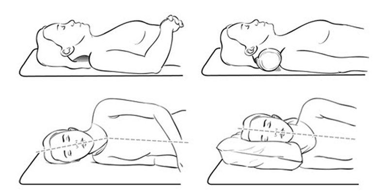 Tác hại của ngủ không kê gối