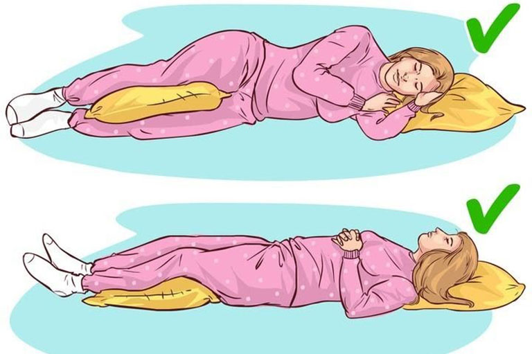 Tư thế ngủ đúng cho người thoát vị đĩa đệm