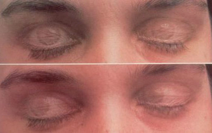 Cách ngủ mà không nhắm mắt và 6 bước đơn giản luyện tập ngủ mở mắt 22 Cách ngủ mà không nhắm mắt