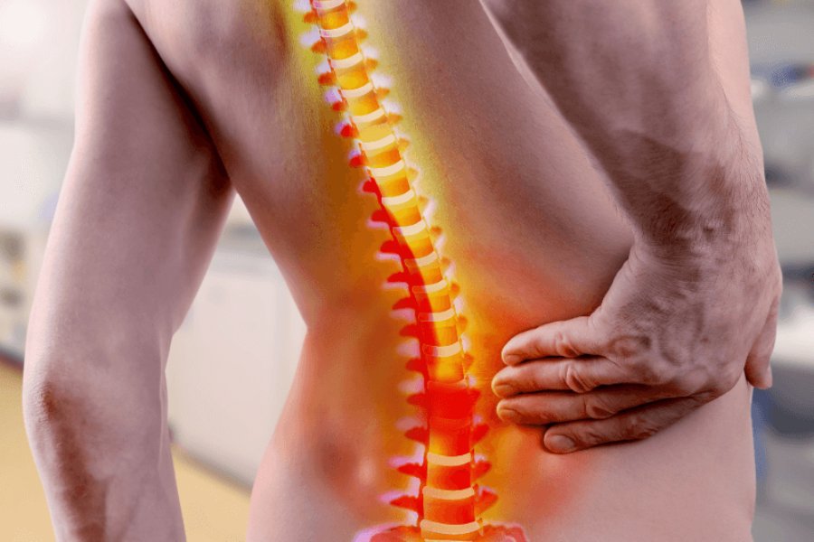 tư thế nằm ngủ không bị đau lưng