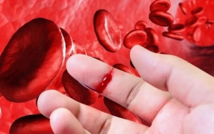 Sáng ngủ dậy có máu trong miệng là dấu hiệu gì? Nguyên nhân và cách xử lý đúng 64 Sáng ngủ dậy có máu trong miệng