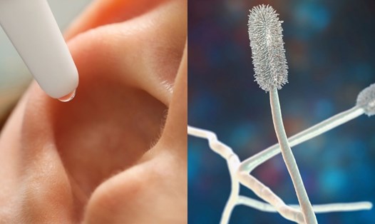 Đeo tai nghe khi ngủ có sao không? 7 rủi ro bạn nên biết trước khi dùng 24 đeo tai nghe khi ngủ có sao không