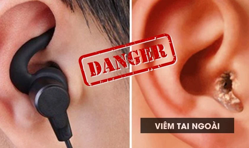 Đeo tai nghe khi ngủ có sao không? 7 rủi ro bạn nên biết trước khi dùng 15 đeo tai nghe khi ngủ có sao không